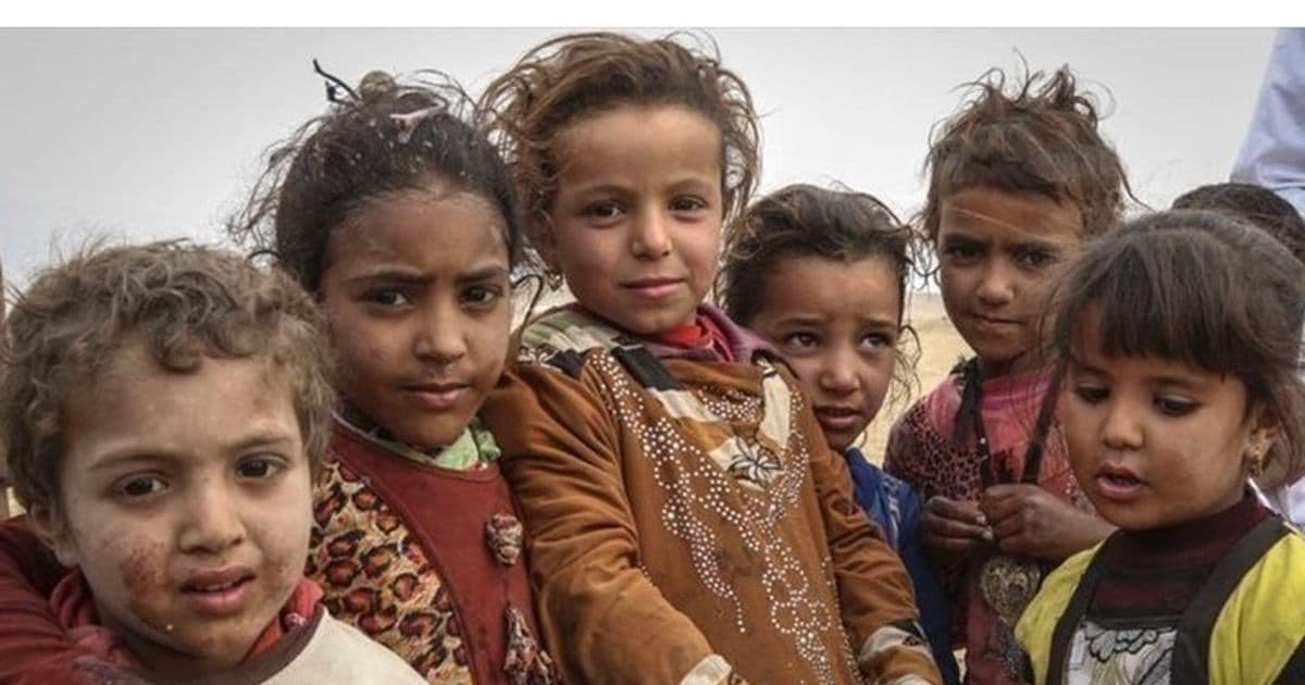 "اليونيسف": نصف مليون طفل في اليمن يعانون من سوء التغذية الحاد