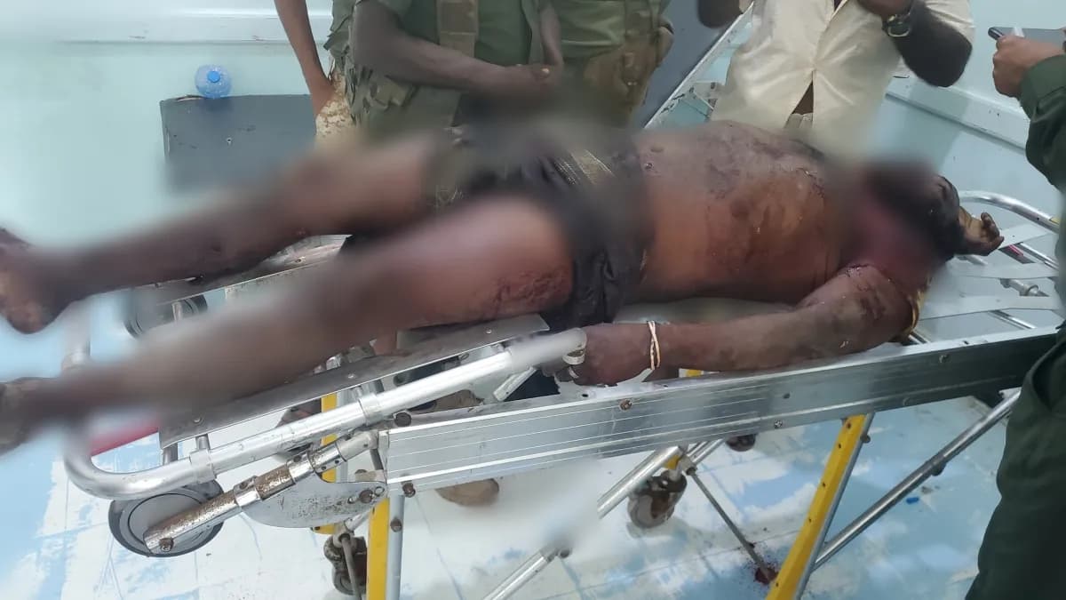 مقتل مواطن بانفجار مقذوف من مخلفات مليشيا الحوثي في الخوخة