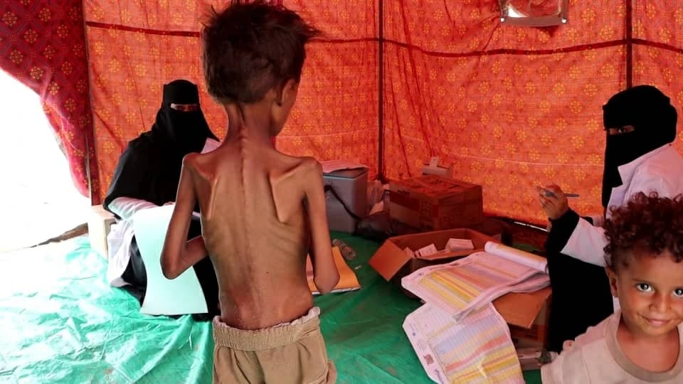 661 جريمة حوثية في تعز خلال 13 يوماً